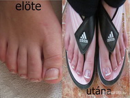 Best Nails - Pedikűr