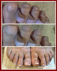Lábköröm meghosszabbítás 