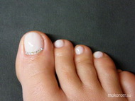 Géllak swarovskival 