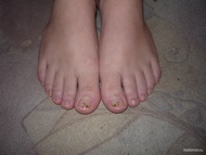 Best Nails - Toe nail decoration