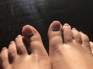 Best Nails - Toe nail decoration