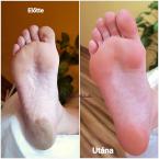 pedikűr kicsit retkesen