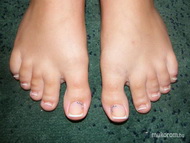 Gellac lábra