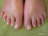 Best Nails - zselé díszítés