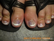 Best Nails - Margarétás gel lac