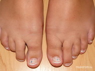 Lábköröm díszítés