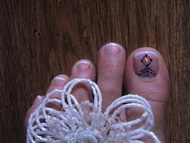 zselé a lábkörmökön