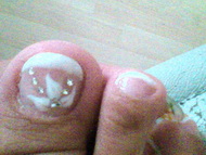 Best Nails - pedizselé 3D díszítéssel