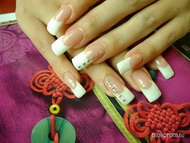 francia köröm kövekkel