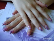 csillámos porcelán