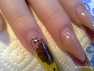 öt hete lenőtt köröm