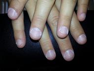 Rágott köröm előtte