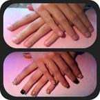 Erősen rágott körömre