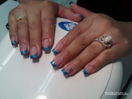 Gán újra önmaga lett