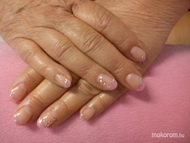 sajátköröm erösitése