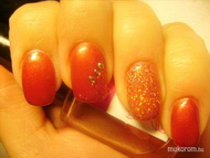 berozsdásodtak a körmeim