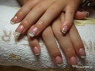 Francia arannyal kövekkel