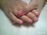 csillámos zselés 2