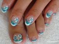 Kéz és láb zselés megerősítés