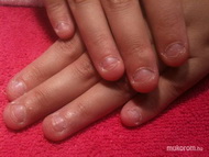 rágott köröm építés előtt