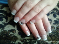 Anyósom első mükörme