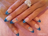 csillámos türkiz zselé 