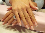 Francia épített zselé