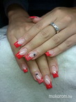 Anett