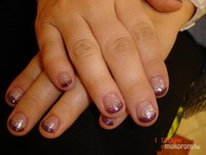 sk erősítés zselével