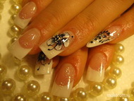 Gele negler i Bergen