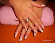 Pici hegyes épített zselé