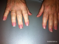 saját köröm erősítése