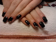 fekete arany kövekkel