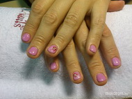 Sajátköröm megerősítése