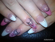 Hozott kép alapján