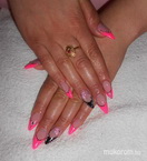 Neon pink és fekete