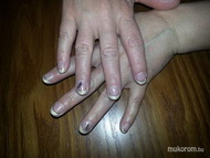 Gyöngyházas végű