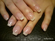 Sk megerősítés zselével