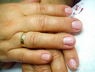 saját köröm megerősítése