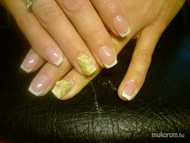 sk megerősítés zselével