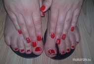 zselés erősítés gél lakkal