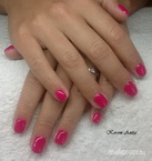 Zselés erősítés gél lakkal