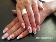 Francia mandula akrillal