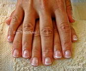 francia koromerositessel