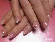 zselés megerősítés