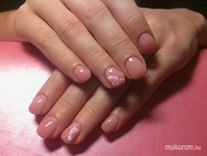 Zselés megerősítés