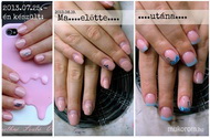 Best Nails - Ella előtte utána
