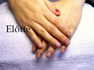 Rágott köröm előtte