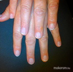 saját köröm megerősítése