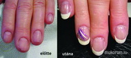 Best Nails - töltés előtt és után
